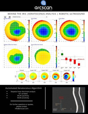 Keratoconus brochure
