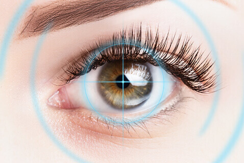 Medical laser centered on woman's eye